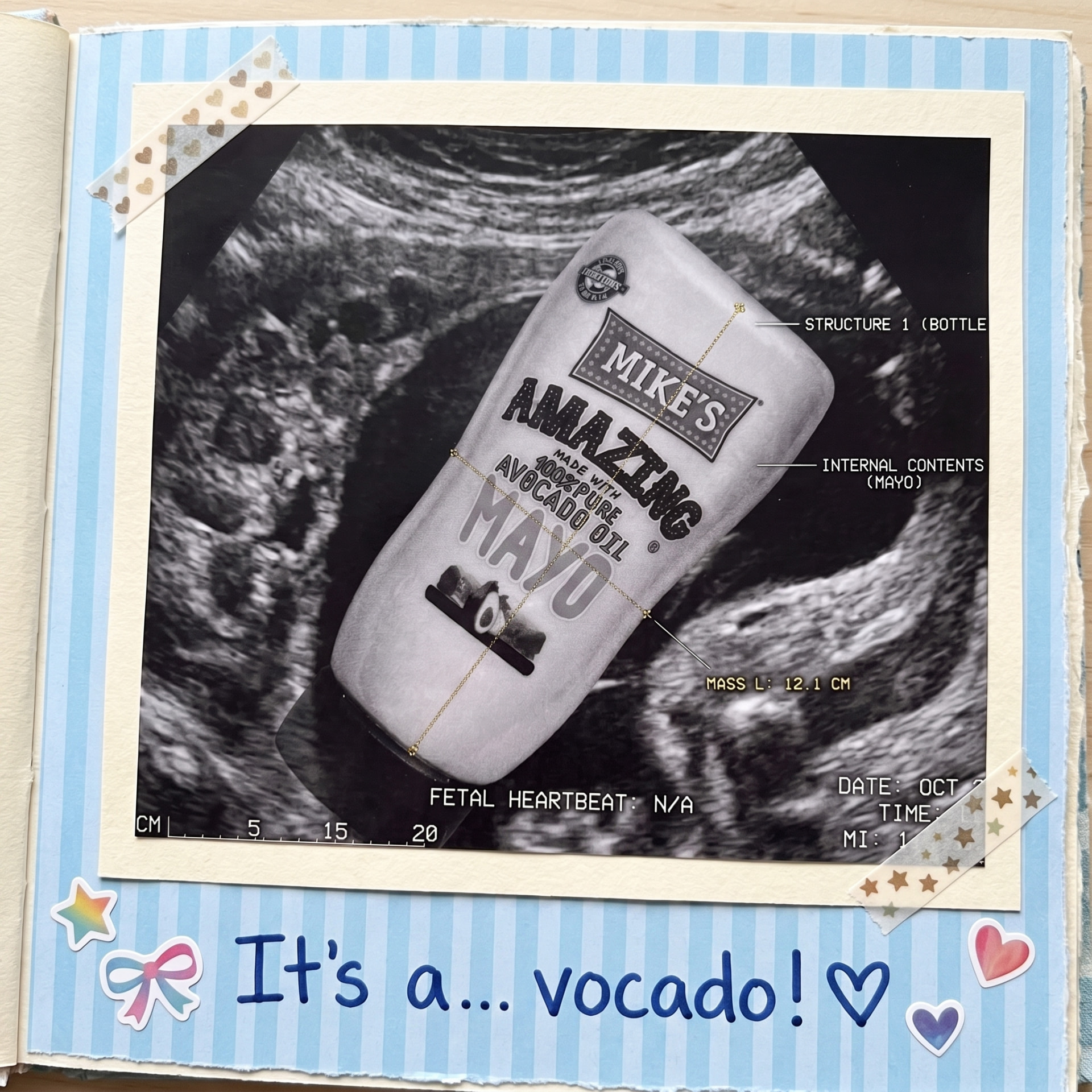 Scrapbook page with an ultrasound of a Mike's Amazing avocado oil mayo bottle
